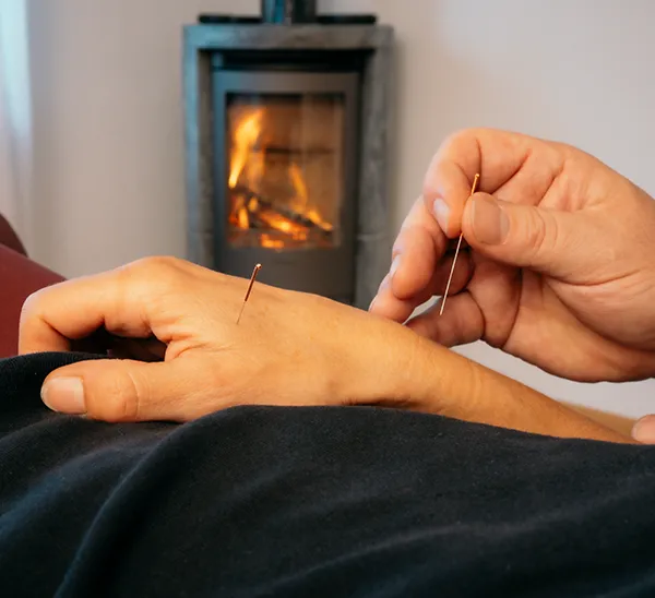 Bildaufnahme beim setzen einer Akutpunkturnadel am Handgelenk